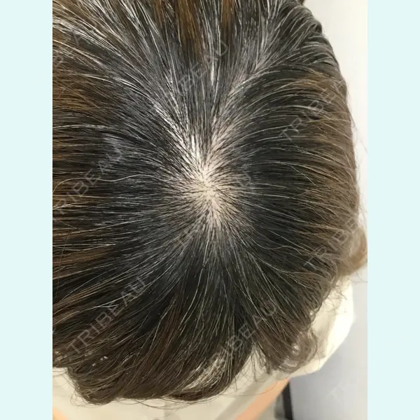 リバイブAGAクリニック 内富一仁医師の症例
