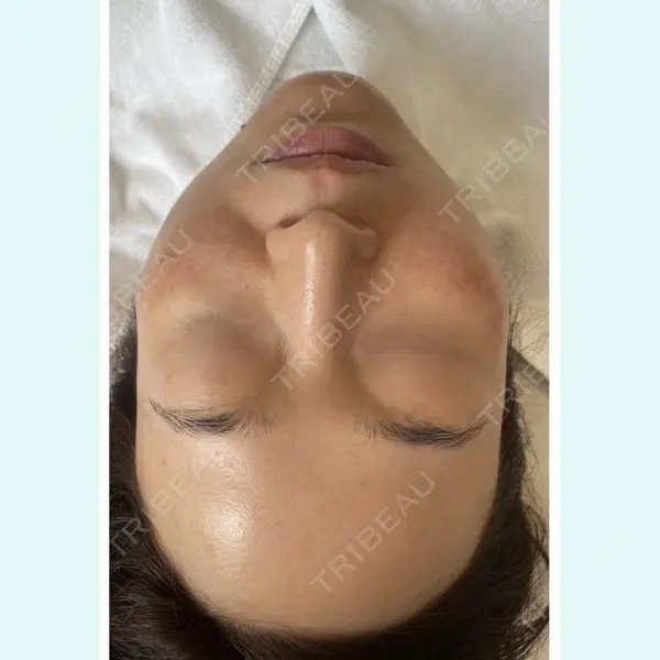 BISIN GINZA CLINICの症例