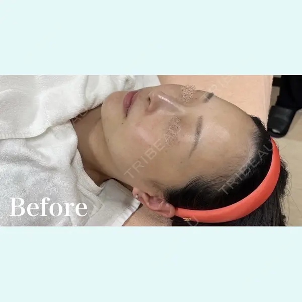 BISIN GINZA CLINICの症例