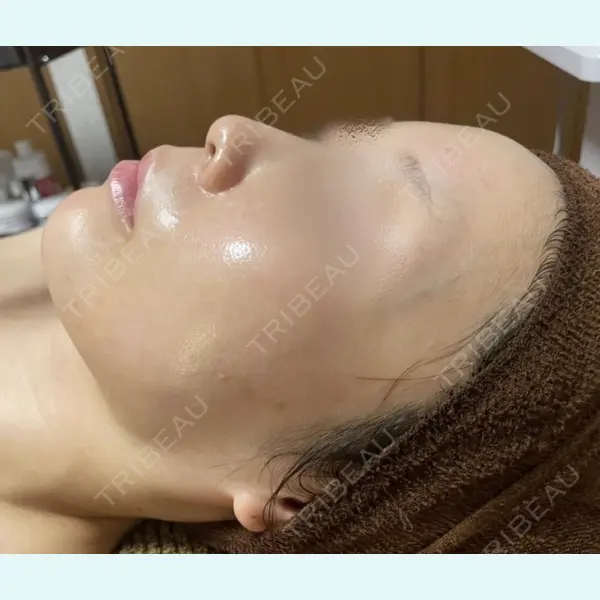 BISIN GINZA CLINICの症例