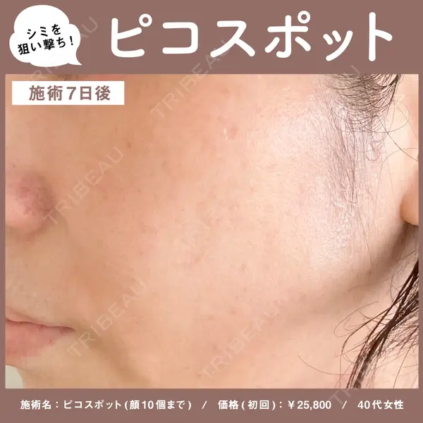新宿Ladies&Gentlemen美容クリニックの症例