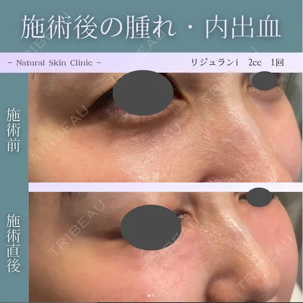 Natural Skin Clinic 笹塚院 圓山 尚医師の症例