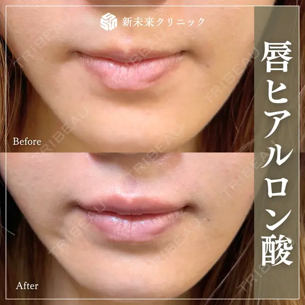 新未来クリニックの症例