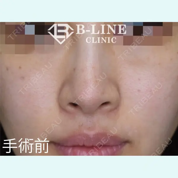 B-LINE CLINIC 池袋院 小池 康弘医師の症例