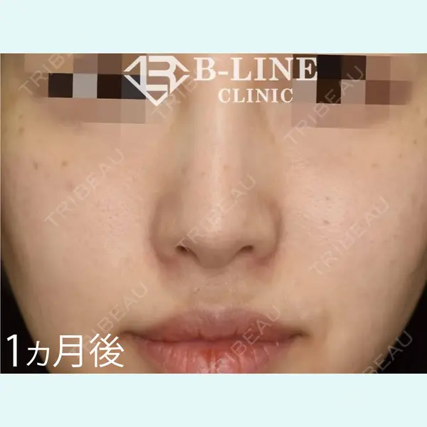 B-LINE CLINIC 池袋院 小池 康弘医師の症例