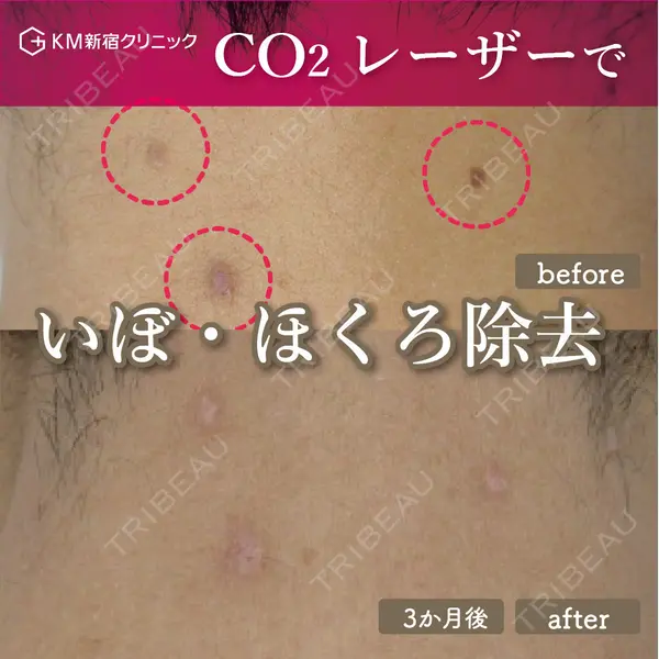 KM新宿クリニック 内藤　崇医師の症例