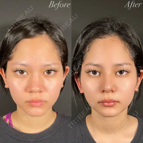R Beauty CLINIC 名古屋院 木村 尚大医師の症例