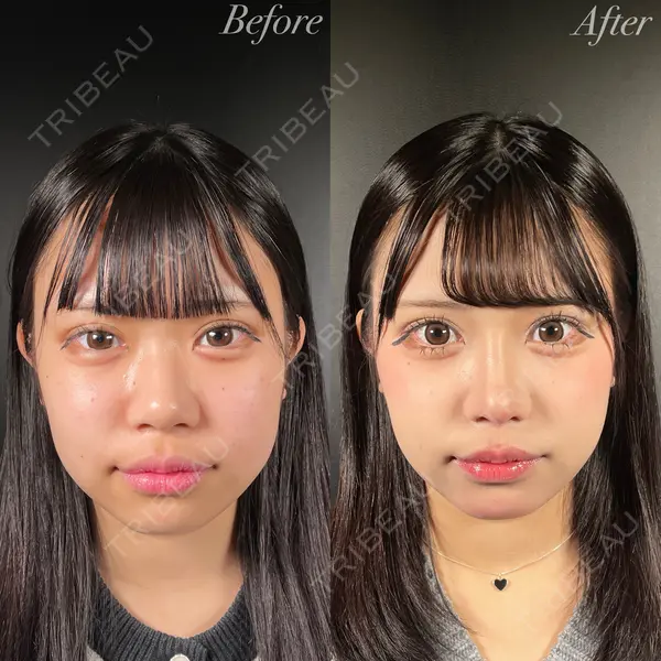 R Beauty CLINIC 銀座院 吉田　慧医師の症例