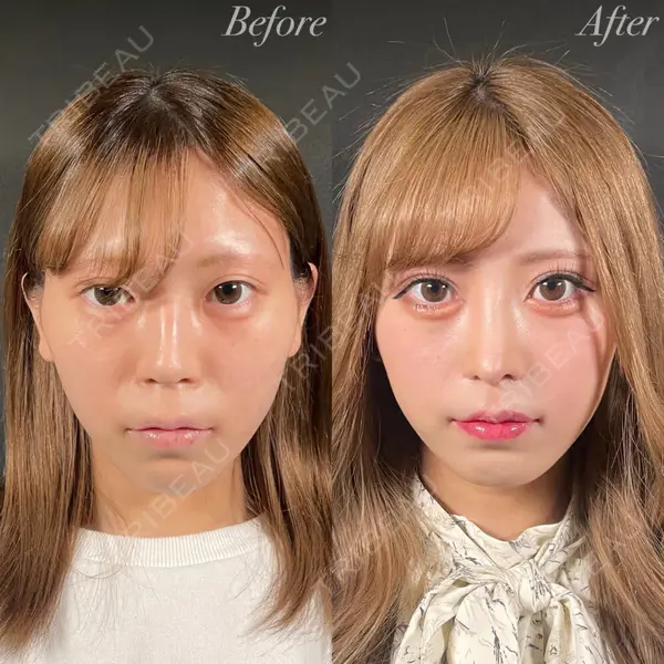 R Beauty CLINIC 銀座院 吉田　慧医師の症例