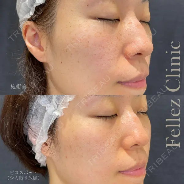 Fellez Clinic【フェルズクリニック】の症例