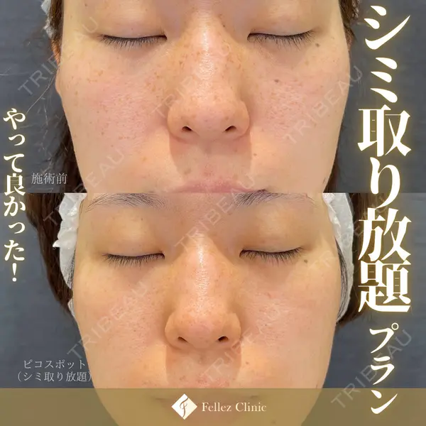 Fellez Clinic【フェルズクリニック】の症例