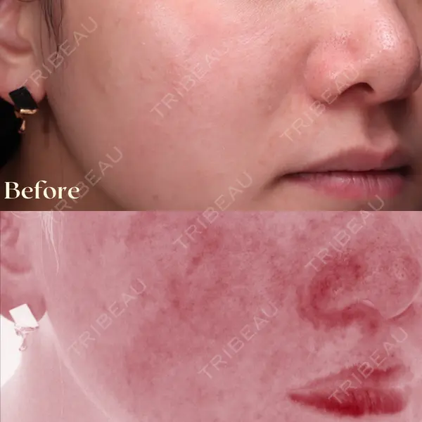 LUNA BEAUTY CLINIC GINZAの症例