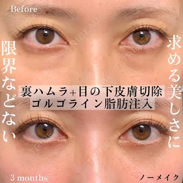 eクリニック 横浜みなとみらい院 坂本 優衣医師の症例