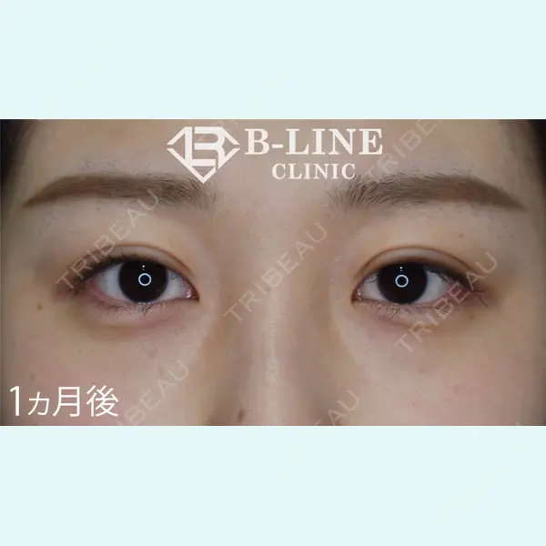 B-LINE CLINIC 池袋院 小池 康弘医師の症例