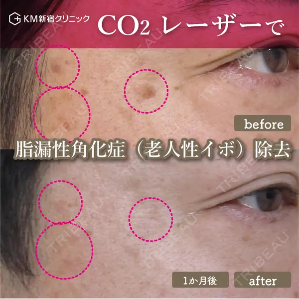 KM新宿クリニック 内藤　崇医師の症例