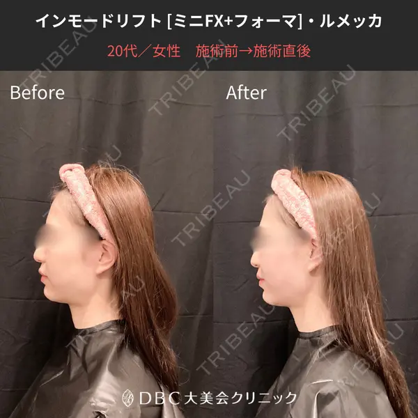 大美会クリニック 梅田院の症例