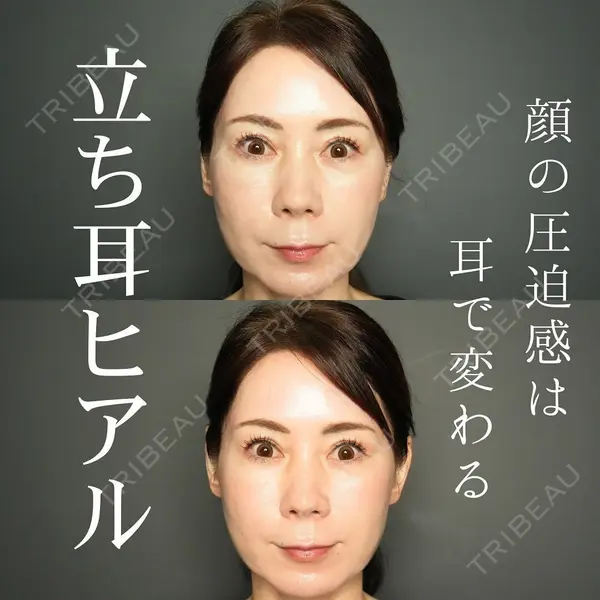 BIANCA銀座 明石 仙姫医師の症例
