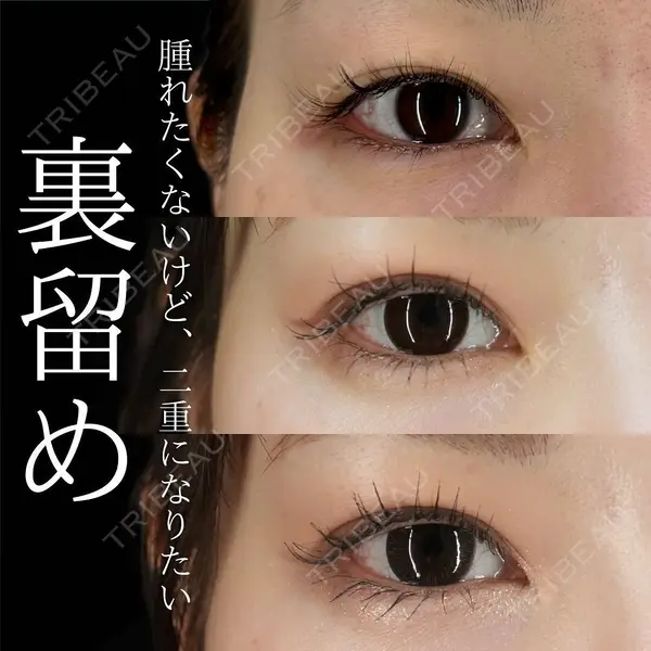 BIANCA銀座 明石 仙姫医師の症例