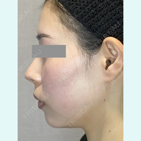 Wi Clinic（ウィ クリニック） 銀座院の症例
