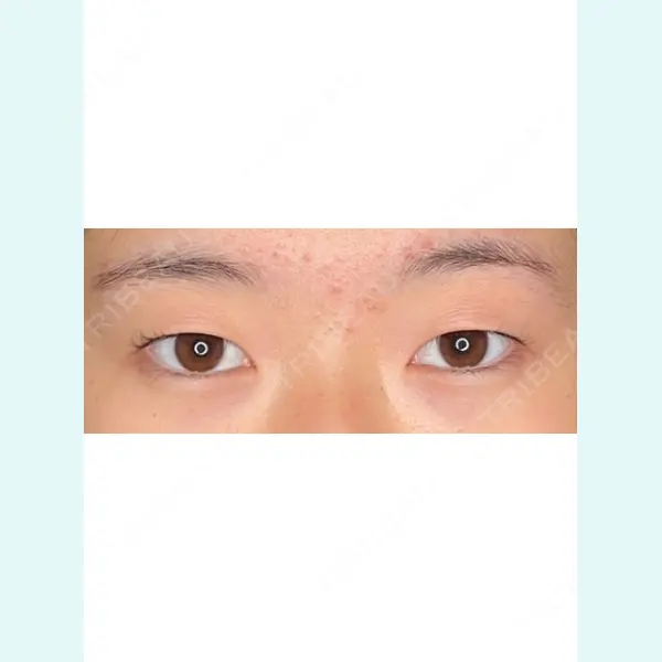 Wi Clinic（ウィ クリニック） 銀座院の症例
