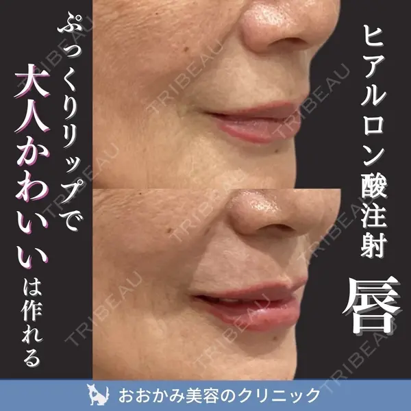 おおかみ美容のクリニック 新宿院 本郷 玲医師の症例