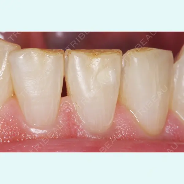 宇田川歯科医院 宇田川 小百合医師の症例