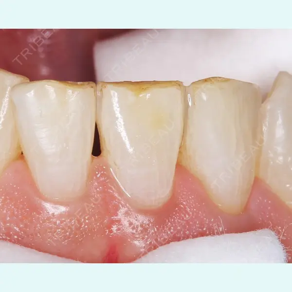 宇田川歯科医院 宇田川 小百合医師の症例