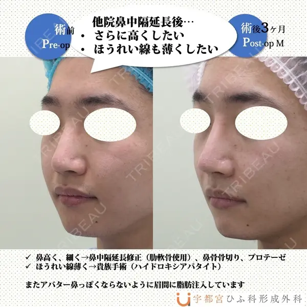 宇都宮ひふ科形成外科 宇都宮 裕己医師の症例