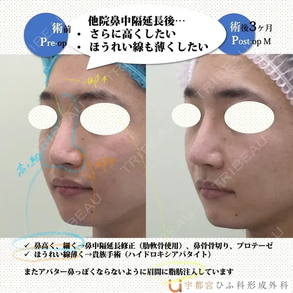 宇都宮ひふ科形成外科 宇都宮 裕己医師の症例