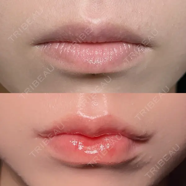 R Beauty CLINIC 銀座院 吉田　慧医師の症例