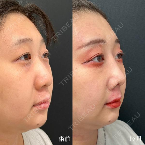 東京シンデレラ美容外科 大宮院の症例