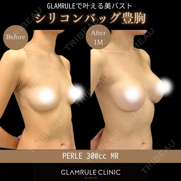 GLAMRULE CLINIC (グラムルール クリニック) 銀座院 藤林 万里子医師の症例