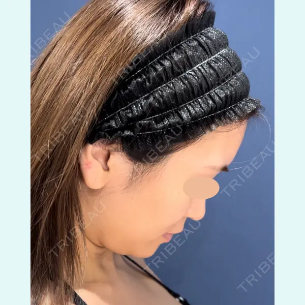 ICON CLINIC 小泉 彰郎医師の症例