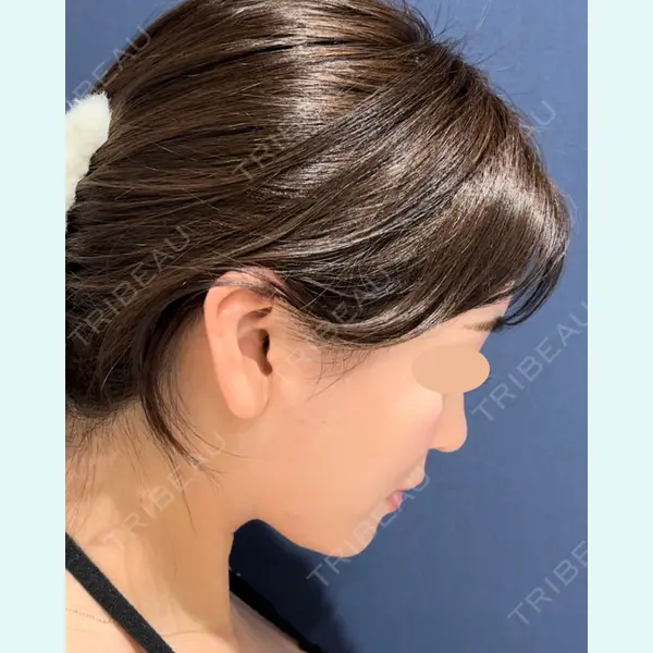 ICON CLINIC 小泉 彰郎医師の症例