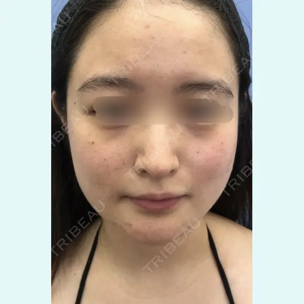 ICON CLINIC 小泉 彰郎医師の症例