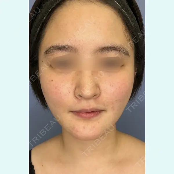 ICON CLINIC 小泉 彰郎医師の症例
