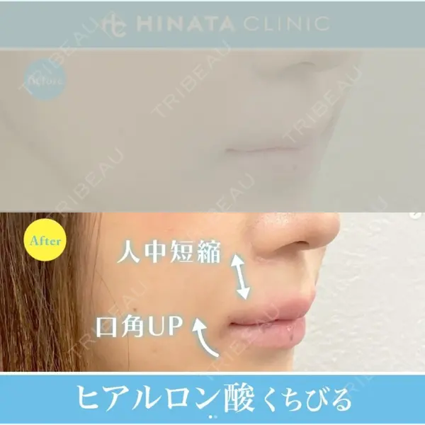 HINATA クリニックの症例