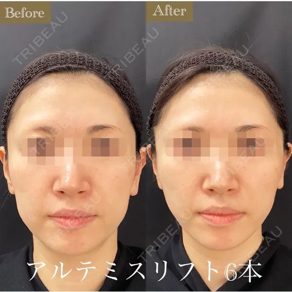 南青山スキンケアクリニック 久保　春香医師の症例