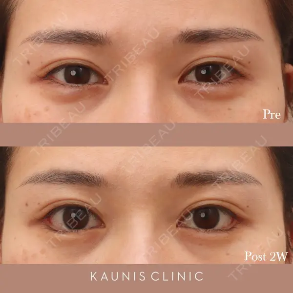 KAUNIS CLINIC（カウニスクリニック） 高野 敏郎医師の症例