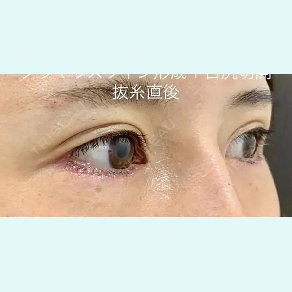 ルラ美容クリニック 渋谷本院 武内 大医師の症例