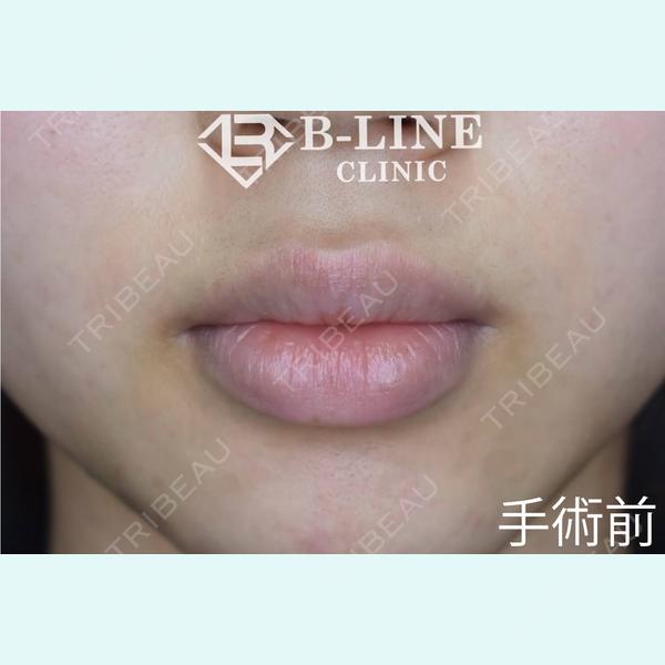 B-LINE CLINIC 池袋院 小池 康弘医師の症例