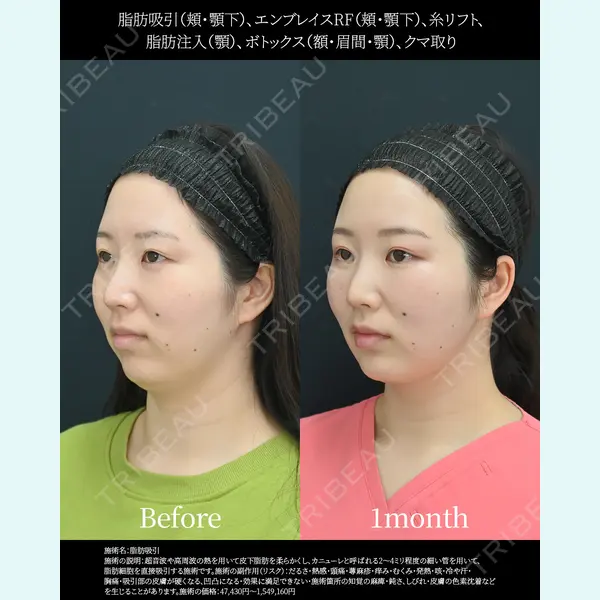 湘南美容クリニック 名古屋院 山本 高士医師の症例