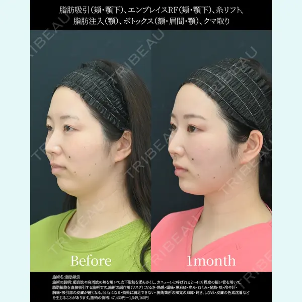 湘南美容クリニック 名古屋院 山本 高士医師の症例