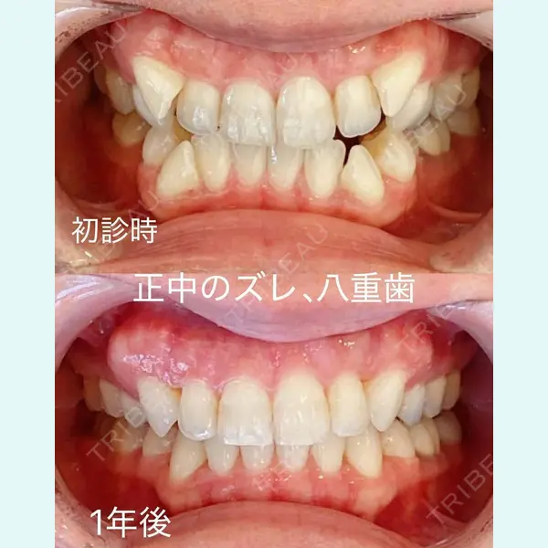 RIVER CLINIC DENTAL 古居 憲医師の症例