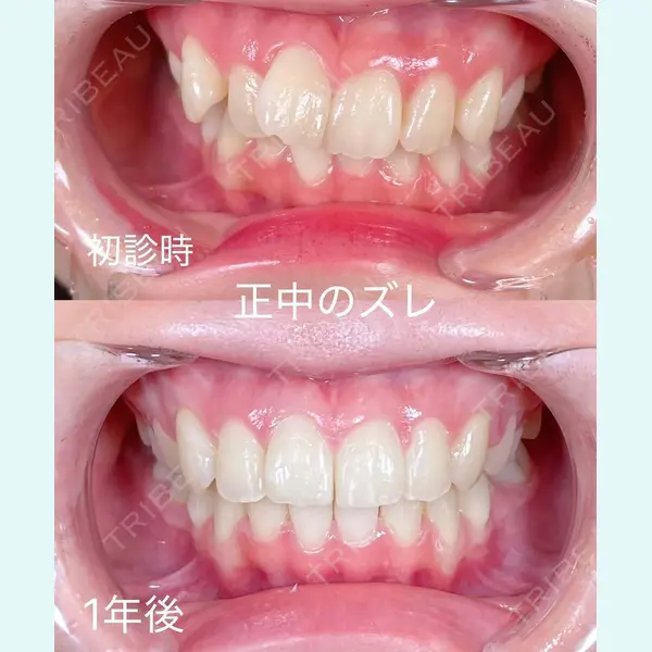 RIVER CLINIC DENTAL 古居 憲医師の症例