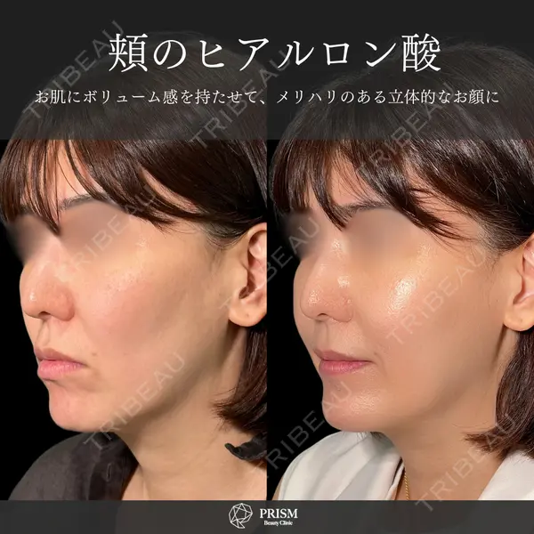 PRISM Beauty Clinic 新宿院 畑山 知輝医師の症例