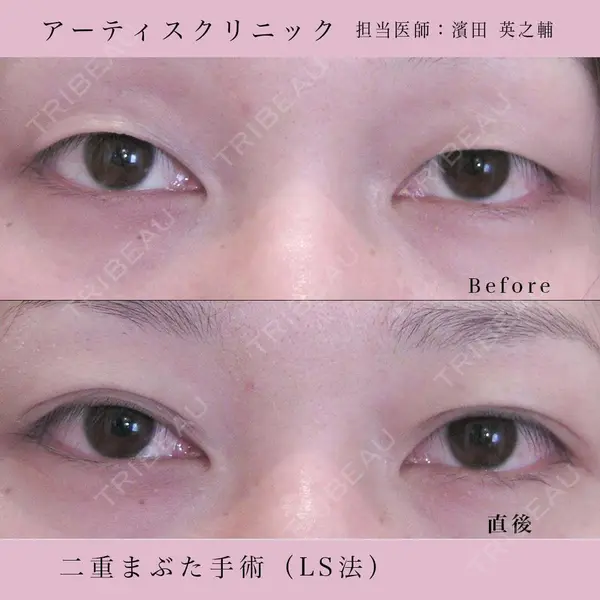 アーティスクリニック 西宮 濱田 英之輔医師の症例