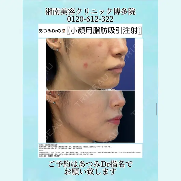 湘南美容クリニック 博多院 渥美 智晶医師の症例