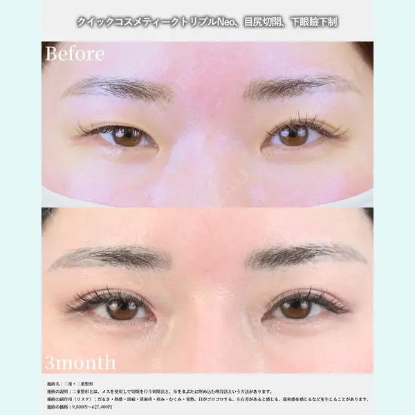 湘南美容クリニック 名古屋院 山本 高士医師の症例