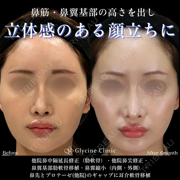 グリシーヌクリニック 藤本 雅史医師の症例